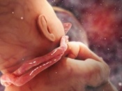Dây rốn quấn cổ thai nhi có gây nguy hiểm cho mẹ và bé không?